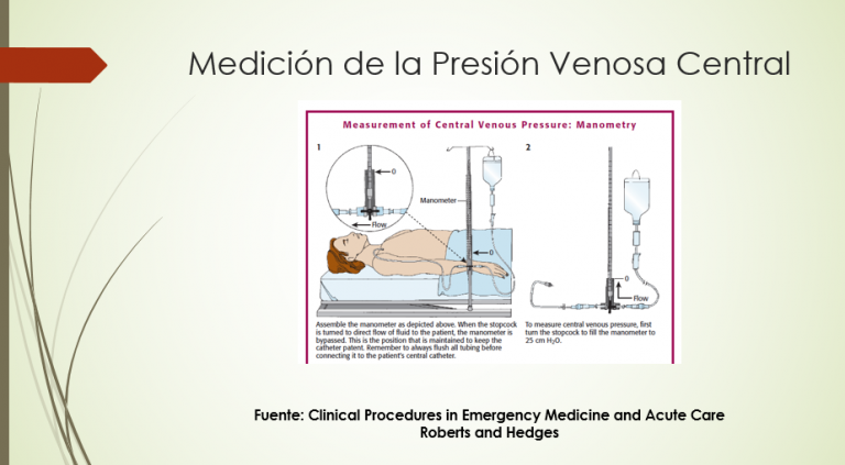 Emergencias Médicas: Técnicas de Venopunción – Gastro Mérida