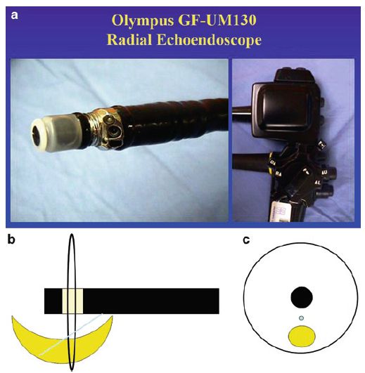 Ultrasonido Radial Olympus gf 130