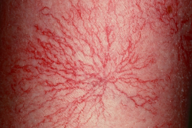 Macula Vascular