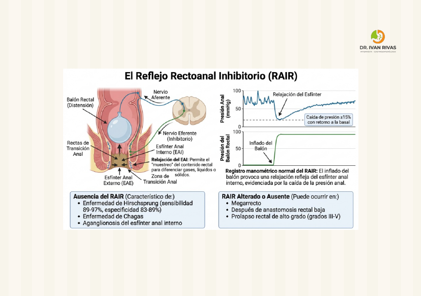 Reflejo rectoanal inhibitorio