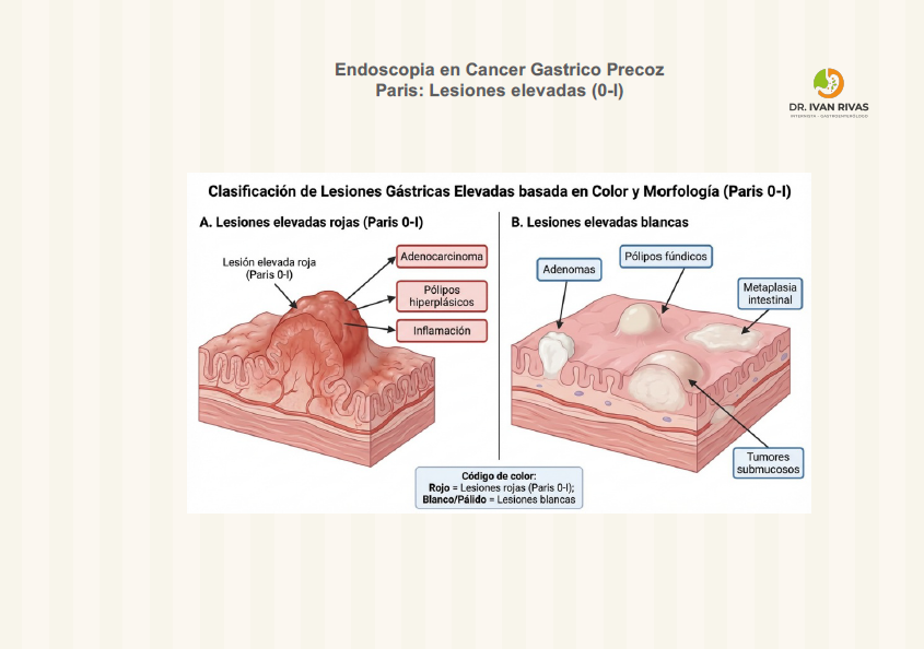 Paris:  color en lesiones elevadas  