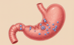 Cáncer Precoz