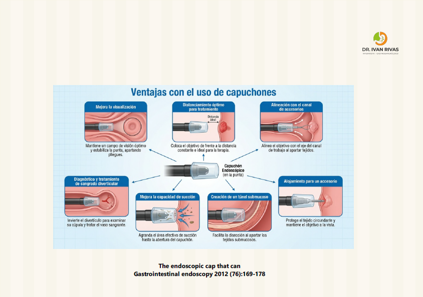 Ventajas del uso de capuchones