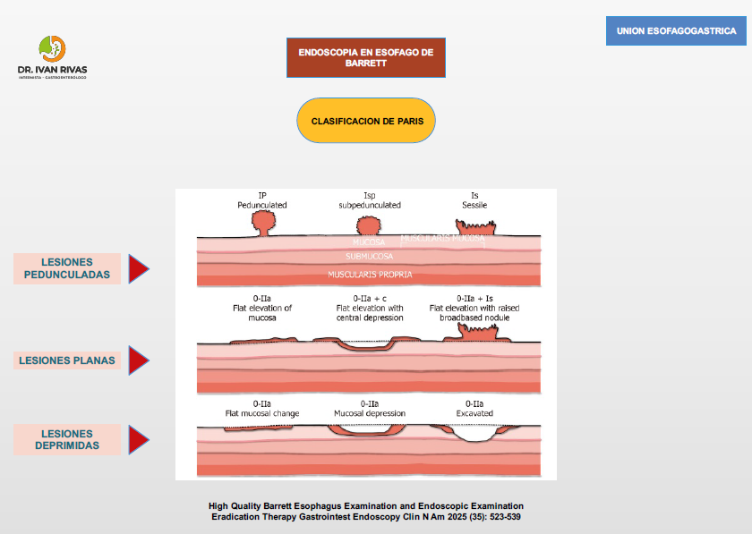 Clasificación de París