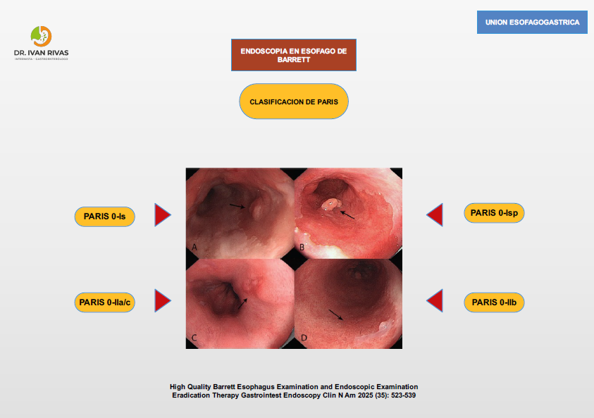 Clasificación de París