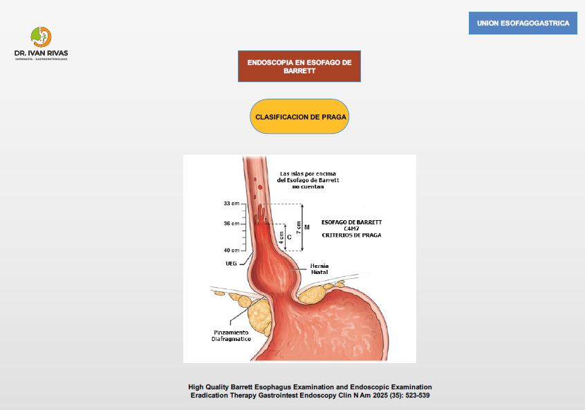 Clasificación de Praga