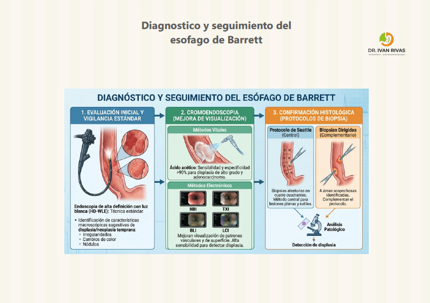 Diagnostico del Esofago de Barrett