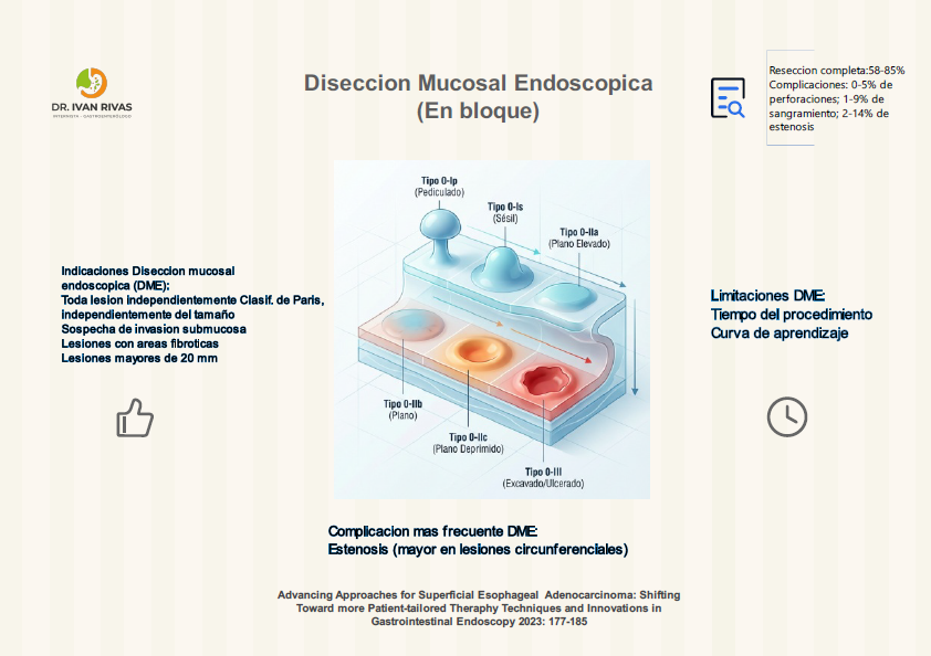 Disección mucosal endoscópica