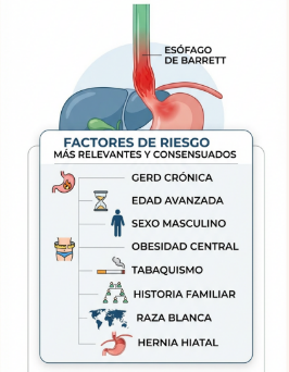 Factores de Riesgo para Esofago de Barrett
