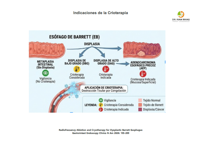 Indicaciones de la crioterapia