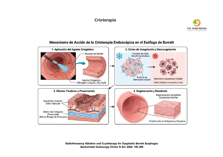 Principios de la Crioterapia