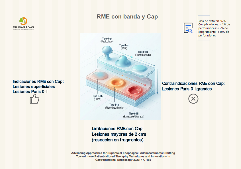Resección mucosal endoscópica con cap y banda