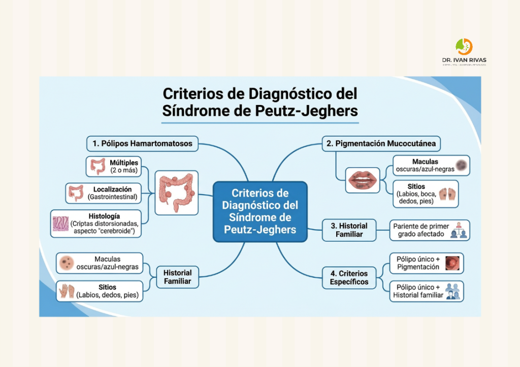 Criterios diagnósticos del síndrome de Peutz-Jeghers