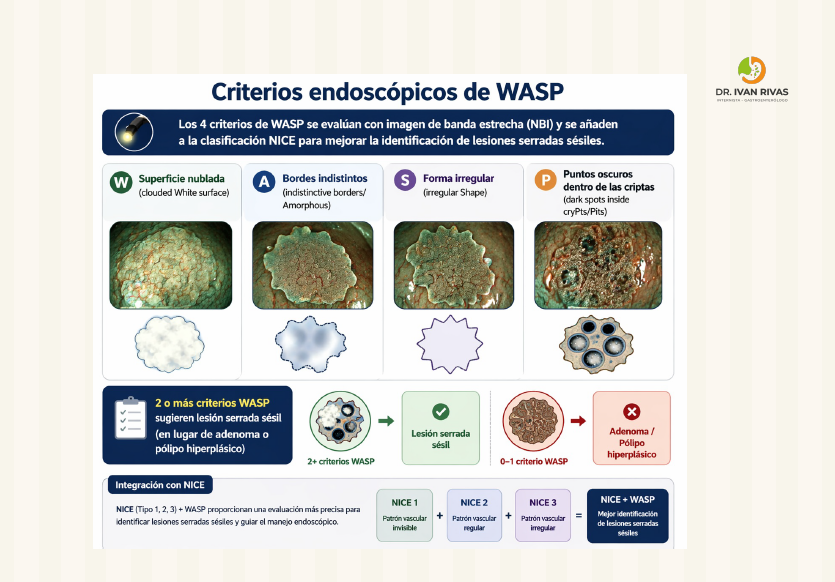 Criterios endoscópicos de WASP