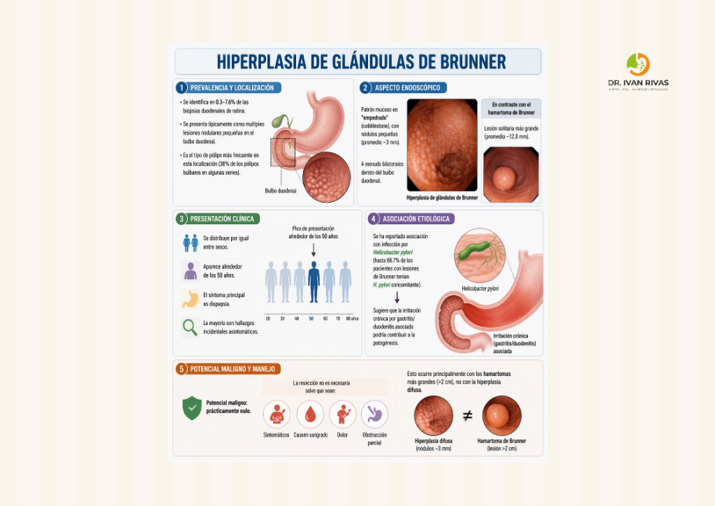 Hiperplasia de glándulas de Brunner