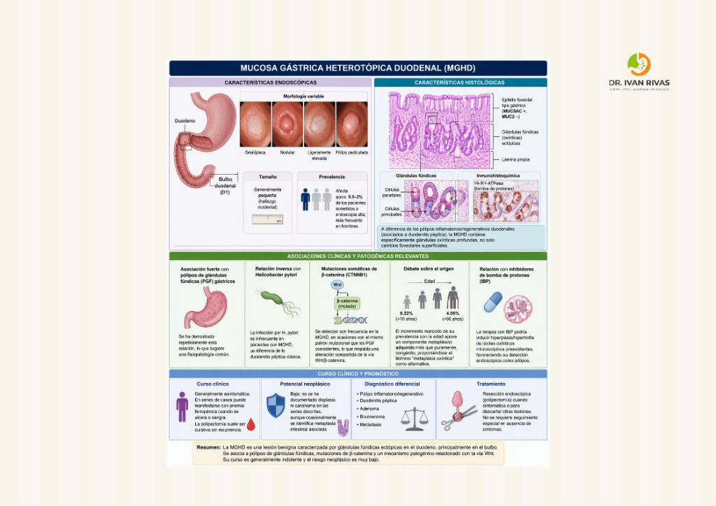 Mucosa gástrica heterotópica duodenal