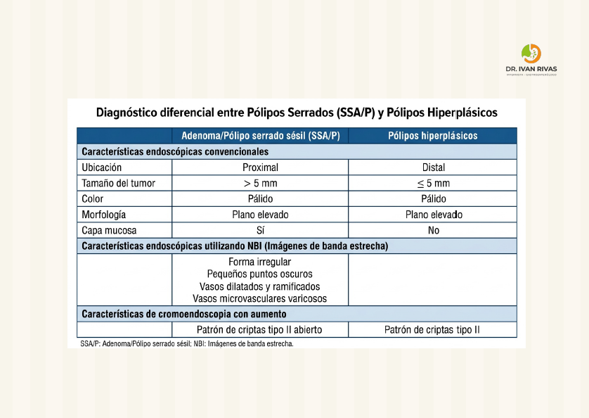 Pólipos serrados e hiperplásicos