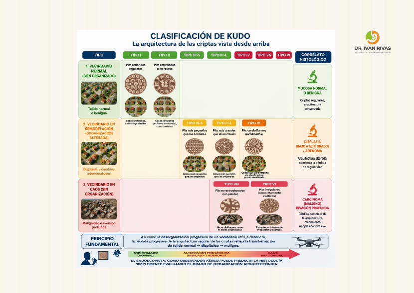 Clasificación de KUDO con NBI