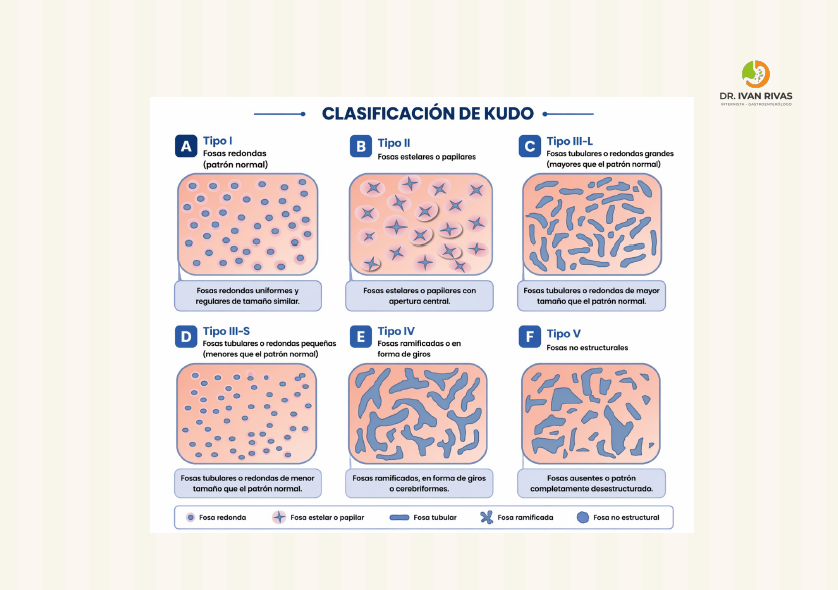 Clasificación de Kudo