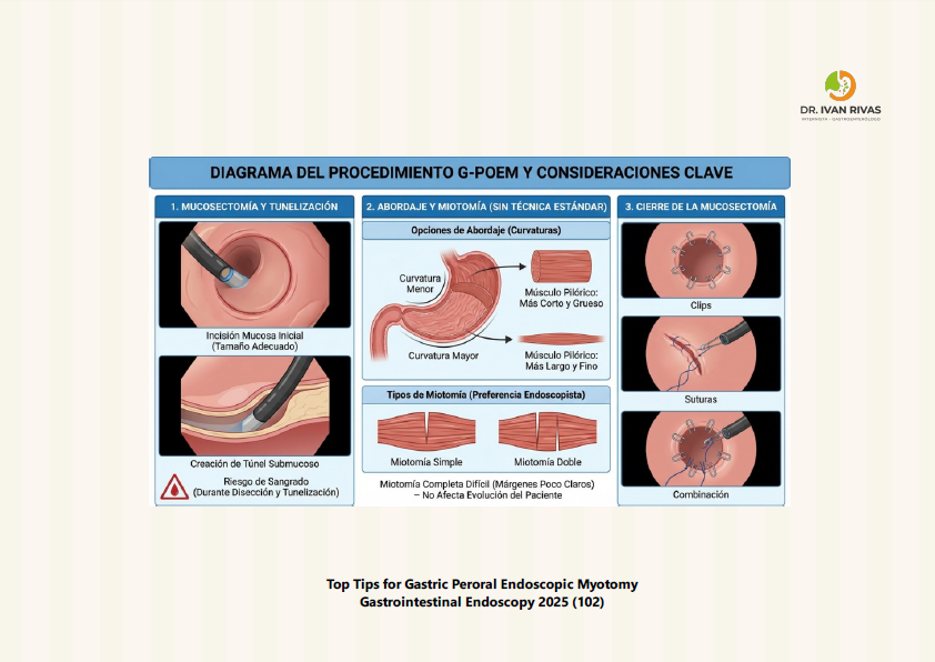 Consideraciones G-POEM