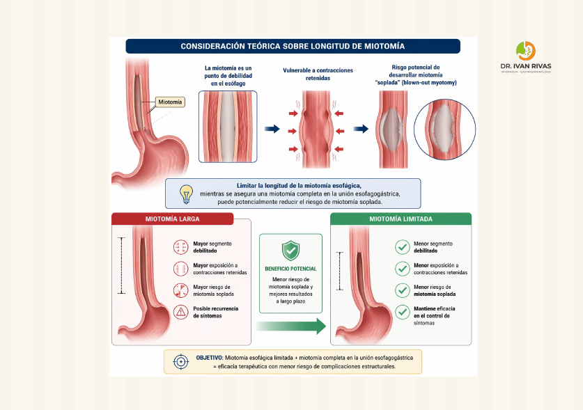 Consideraciones sobre la longitud de la miotomía