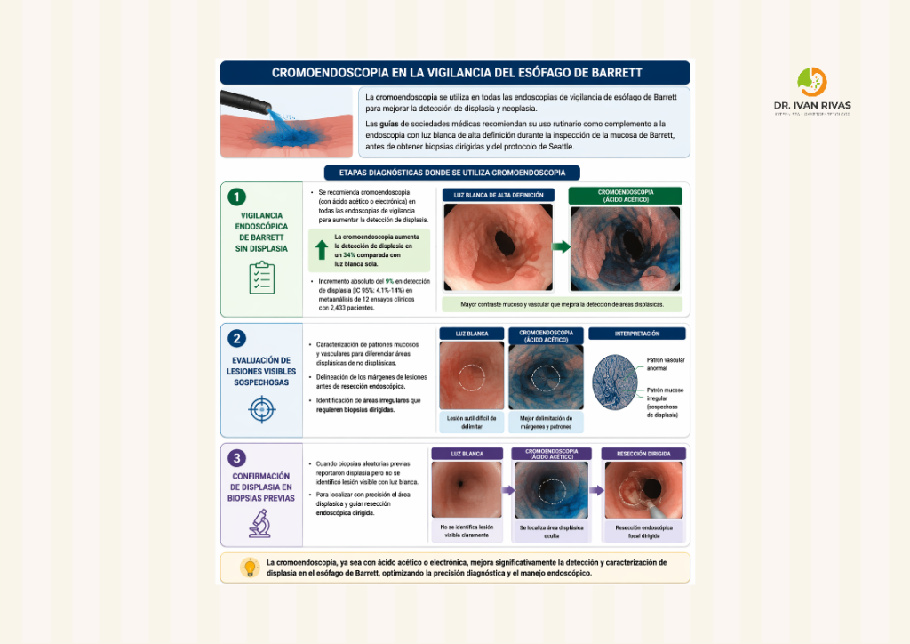 Cromoendoscopia en la vigilancia del esofago de Barrett
