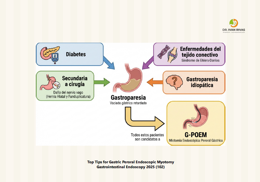Etiología de la Gastroparesia