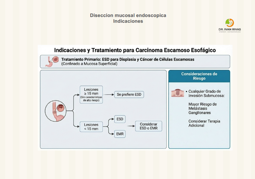 Indicaciones de la disección mucosal endoscópica para cáncer de celulas escamosas del esofago