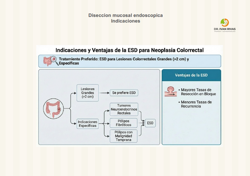 Indicaciones de la disección mucosal endoscópica para neoplasias colorrectales