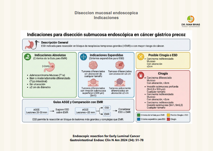 Indicaciones de la disección mucosal endoscópica
