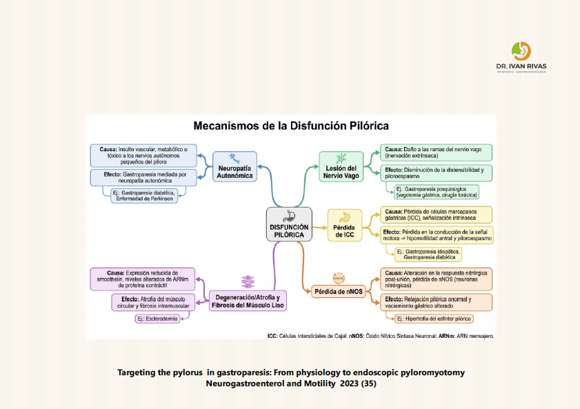 Mecanismos de disfunción pilórica