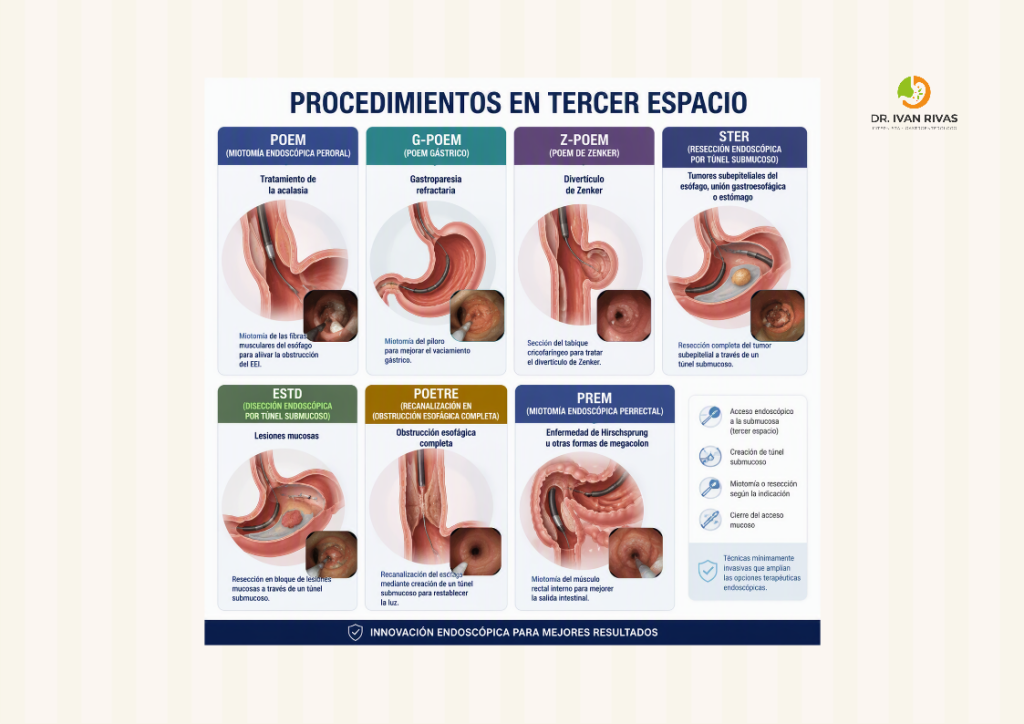 Procedimientos en tercer espacio