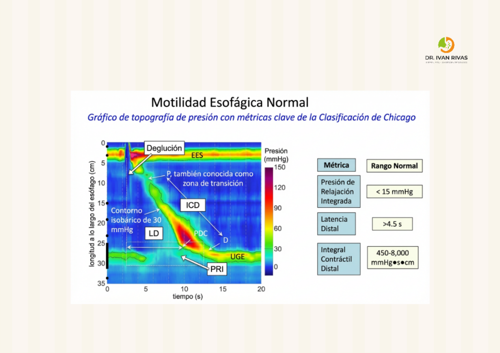 Métricas claves en la manometría esofágica de alta resolución