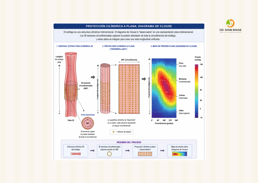 Representación Bidimensional en la manometría esofágica de alta resolución