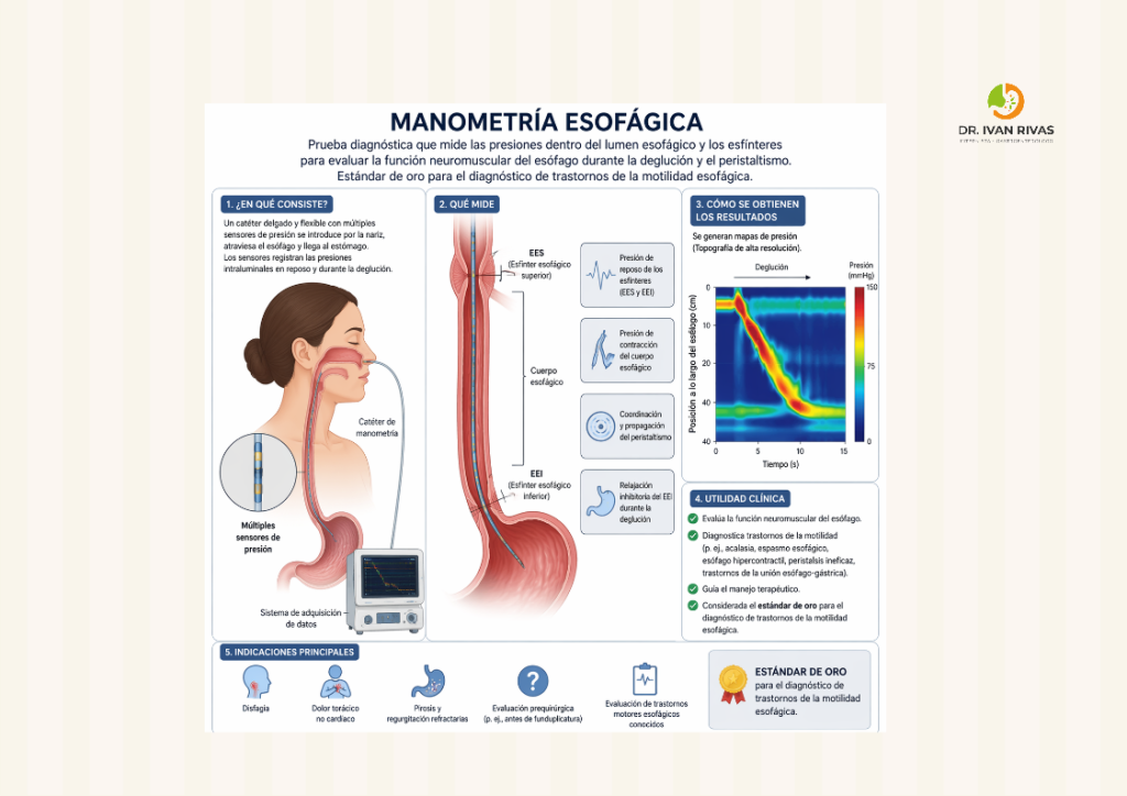 Concepto de Manometría Esofágica