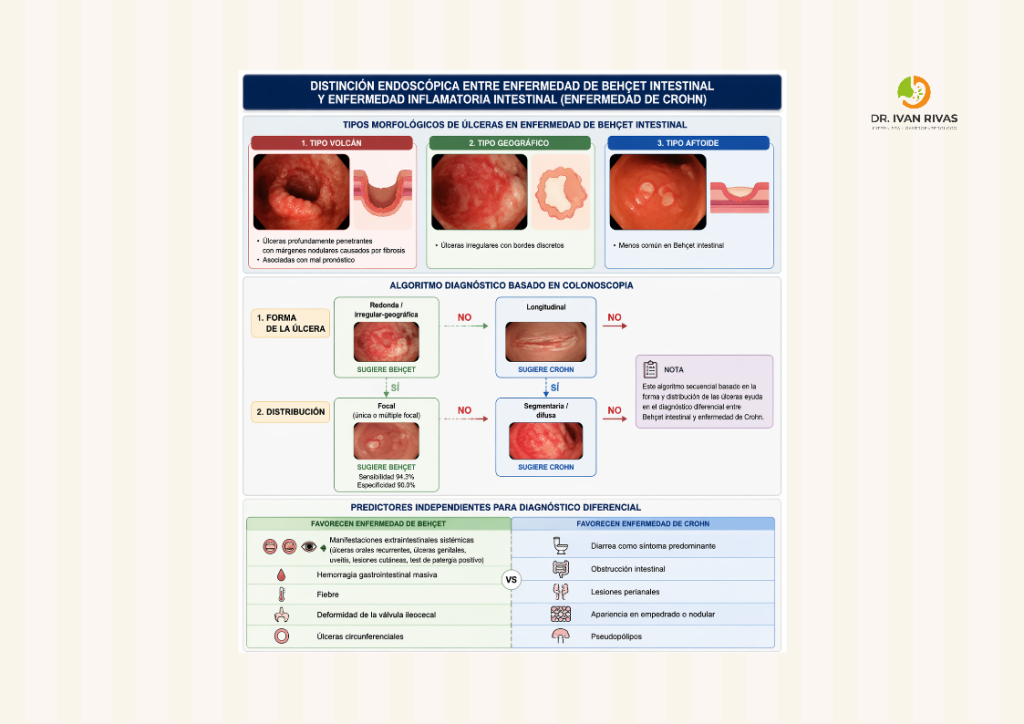 Diagnóstico diferencial de enfermedad de Crohn y enfermedad de Behcet