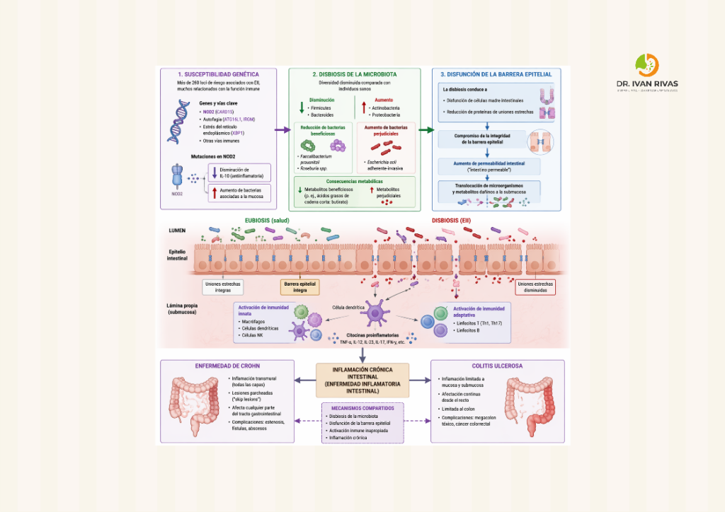 Fisiopatología de la enfermedad inflamatoria intestinal
