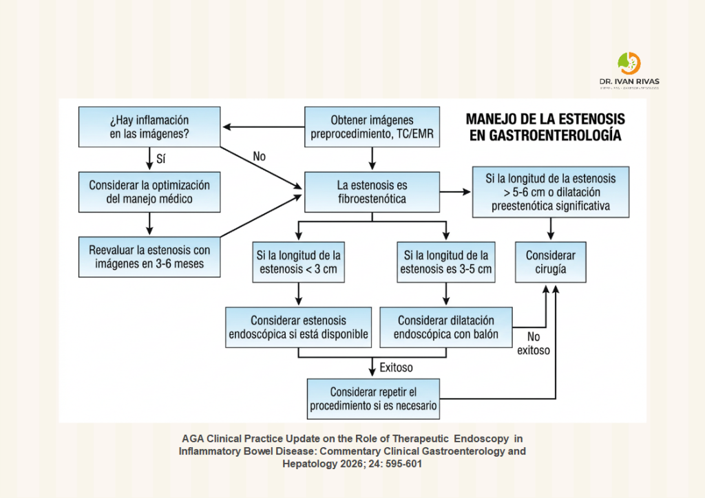 Manejo de las estenosis en enfermedad inflamatoria intestinal