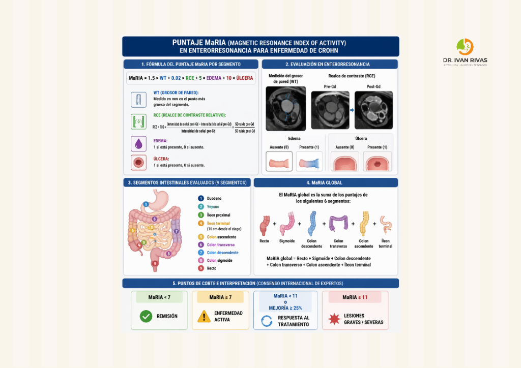 Puntaje Maria para enfermedad de Crohn