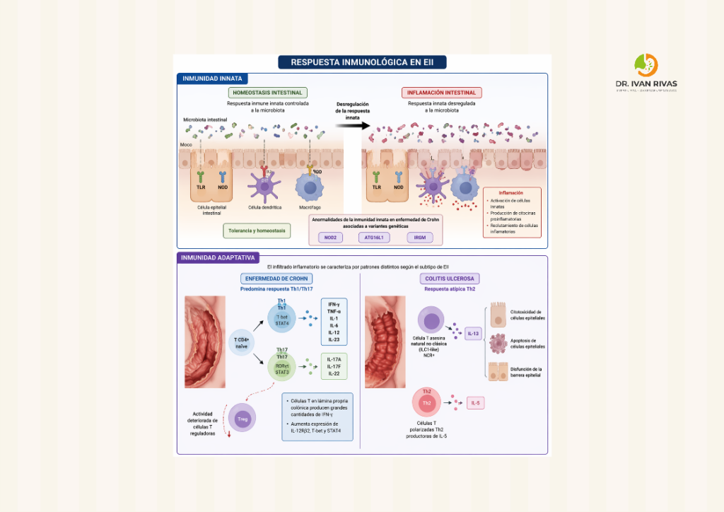 Respuesta inmunológica en la enfermedad inflamatoria intestinal