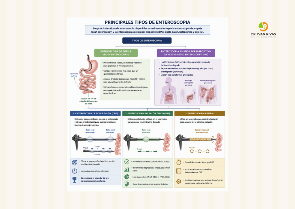 Tipos de enteroscopia