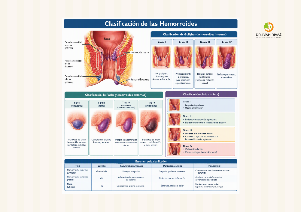 Clasificación de las hemorroides