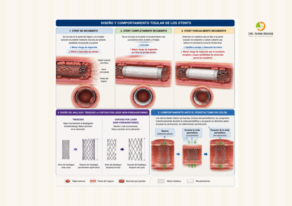 Comportamiento de los diferentes tipos de stent