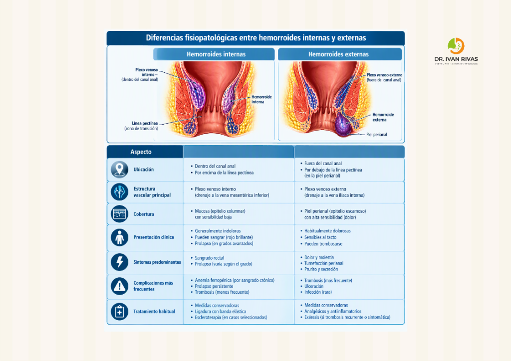 Diferencias entre hemorroides internas y hemorroides externas