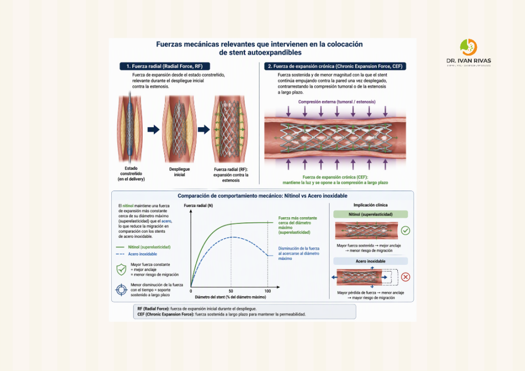 Fuerzas mecánicas en stents autoexpandibles