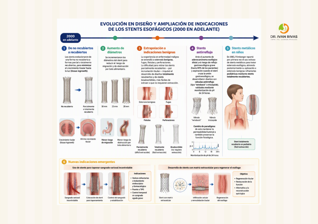 Nuevas indicaciones de los stents esofágicos