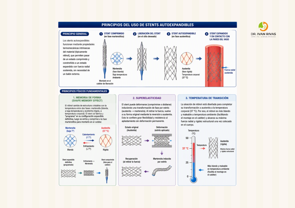 Stents autoexpandibles