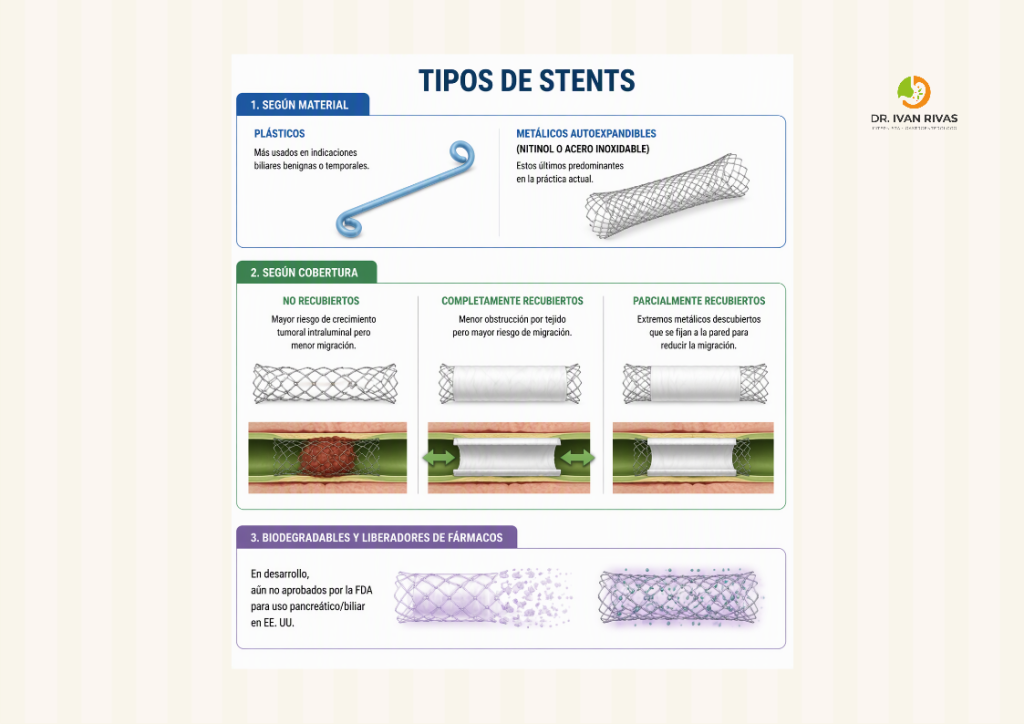 Tipos de stents