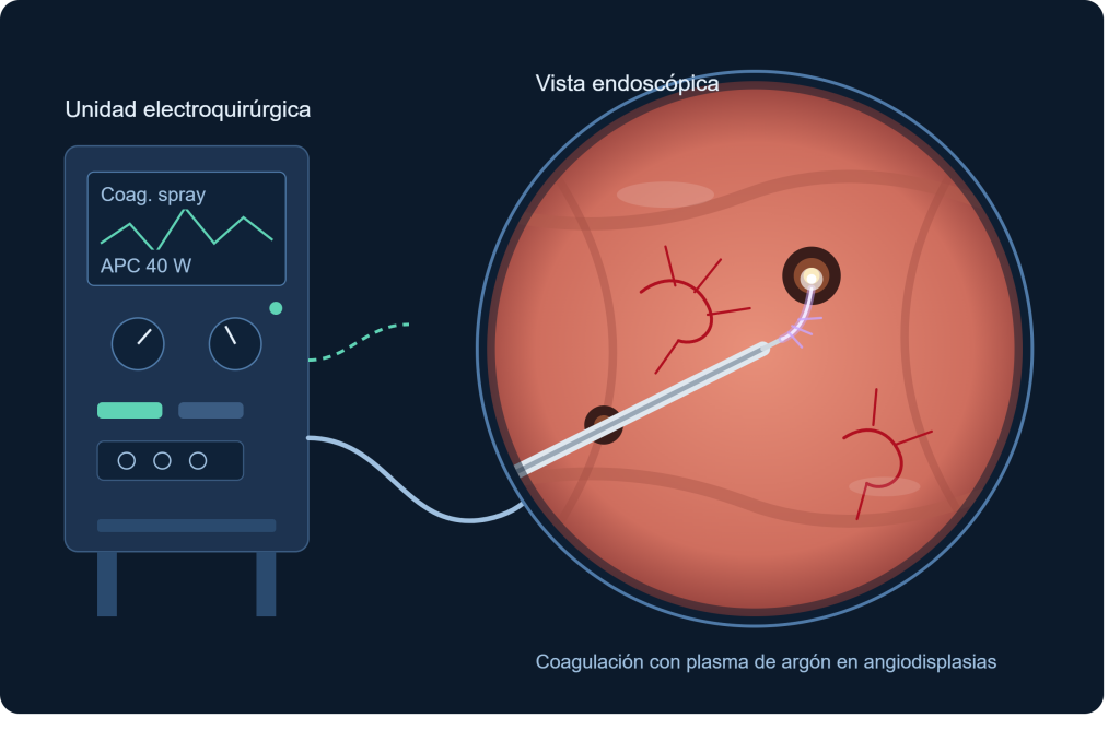 Manejo de unidades electroquirúrgicas en gastroenterología