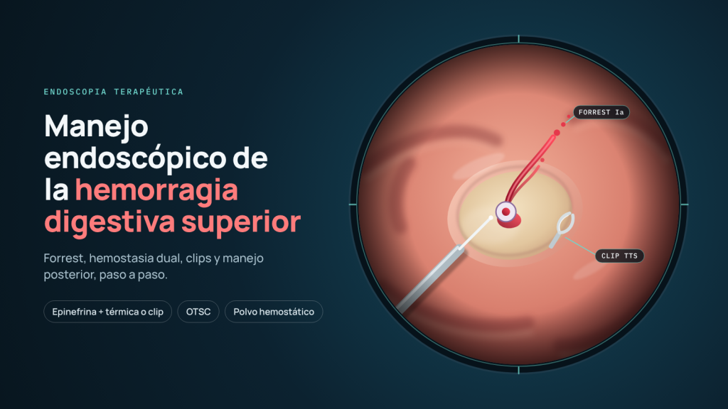 Hemorragia Digestiva Superior